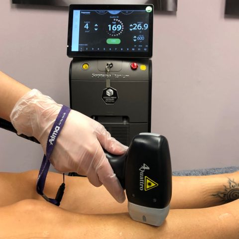 Haarentfernung im Bereich Bein mit Lasertherapie